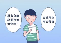 成都去哪儿治疗白癜风好