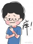 成都治疗湿疹专科医院哪家好
