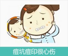 成都青春痘哪个医院好