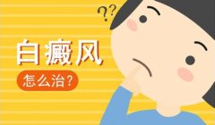 成都哪家白癜风医院好