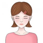 成都哪家医院黄褐斑好