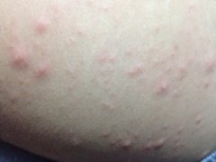 成都市治疗皮炎好的医院