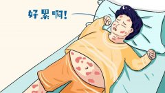 看牛皮癣成都市哪家医院好